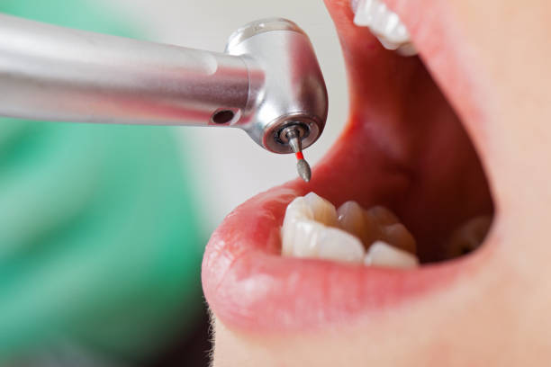 Best Emergency Dental Services for Seniors in Heflin, AL